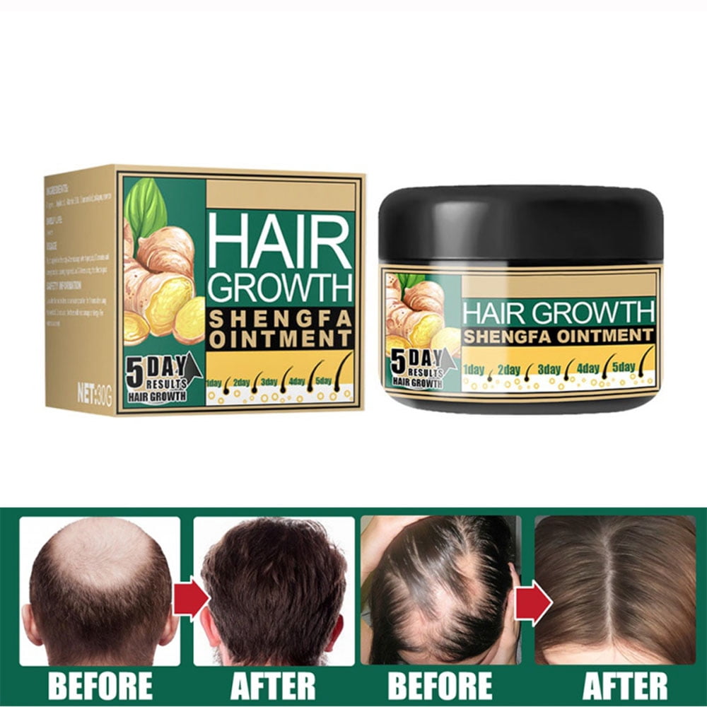 30g Natural Ginger Hair Growth Cream, Massage Hair Follicle Hair Care Essence Cream for Hair