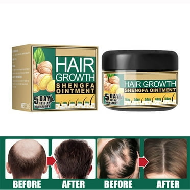 30g Natural Ginger Hair Growth Cream, Massage Hair Follicle Hair Care Essence Cream for Hair Loss and Hair Thinning Treatment (1pcs)