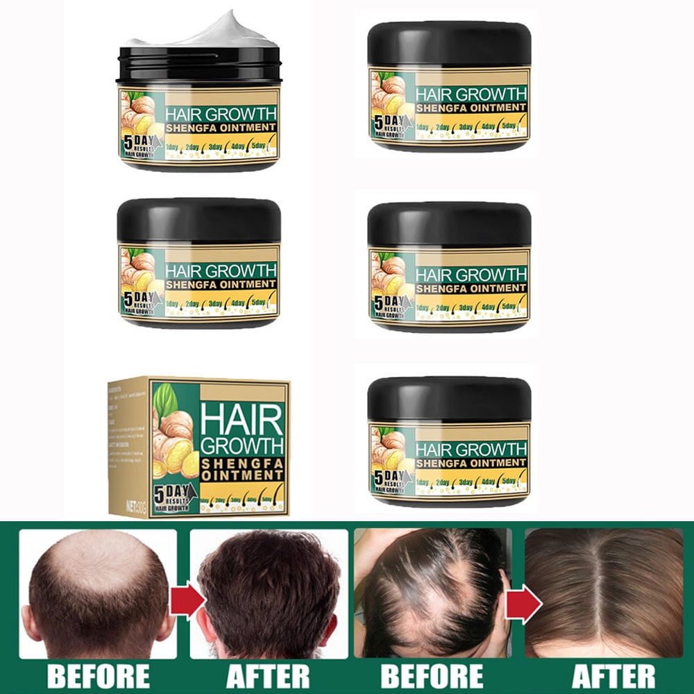 30g Natural Ginger Hair Growth Cream, Massage Hair Follicle Hair Care Essence Cream for Hair