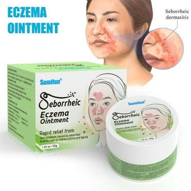 30g Seborrheic Eczema Ointment Fast-Acting Treatment Seborrheic Relief Cream for Seborrheic Dermatitis Psoriasis