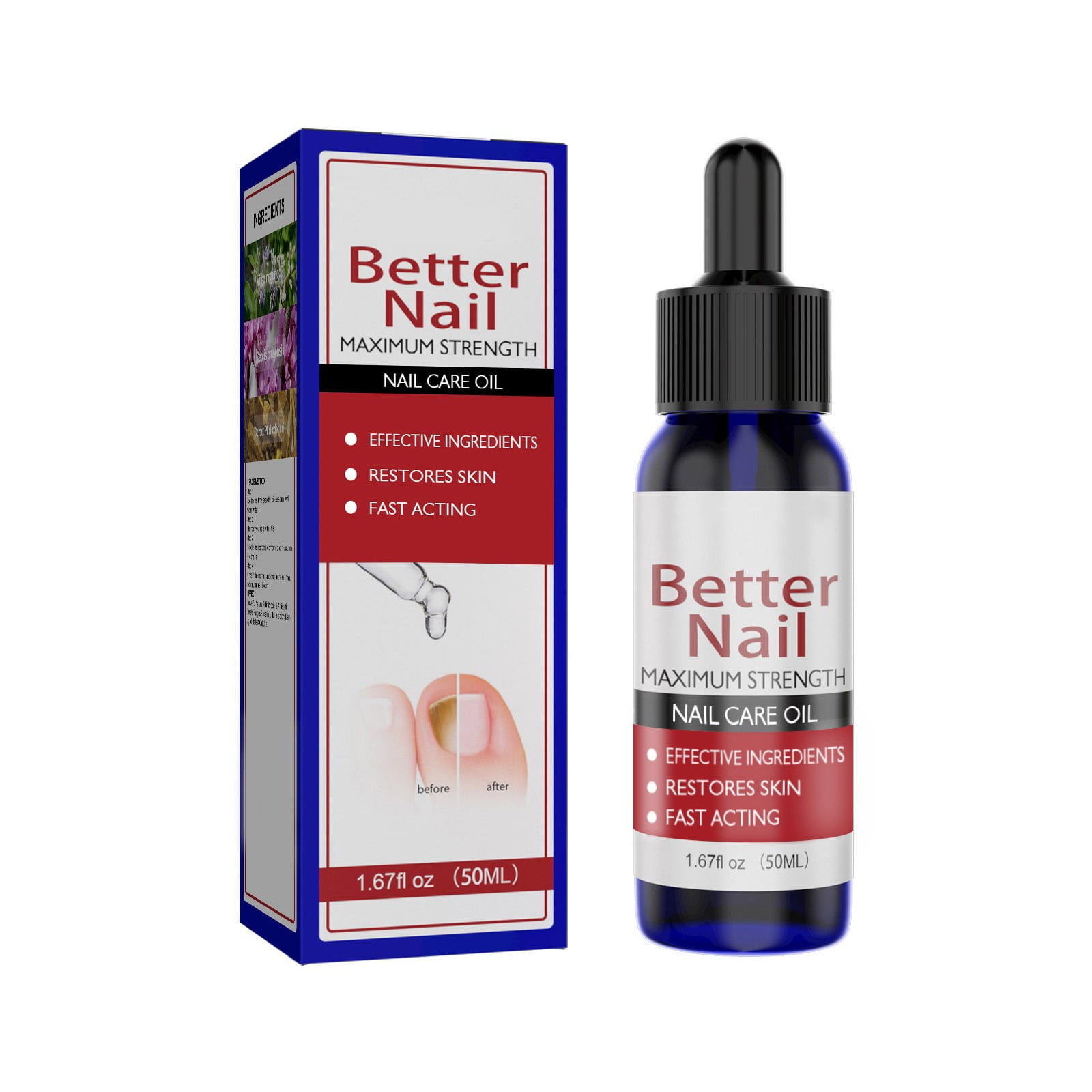 30ml Ingrown Toenail Treatment Ingrown Toenail Pain Reliever and