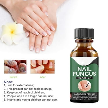 BUYHO 30ml Toenail Care Nail Oil Soft Nail Yellowing Nail Thickening Concave Inner Nail Embedding Brightening Nail Liquid