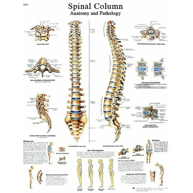 3B Anatomical Chart - Rheumatic Diseases 20 x 26'' 3B Anatomical Chart - Rheumatic Diseases 20 x 26''
