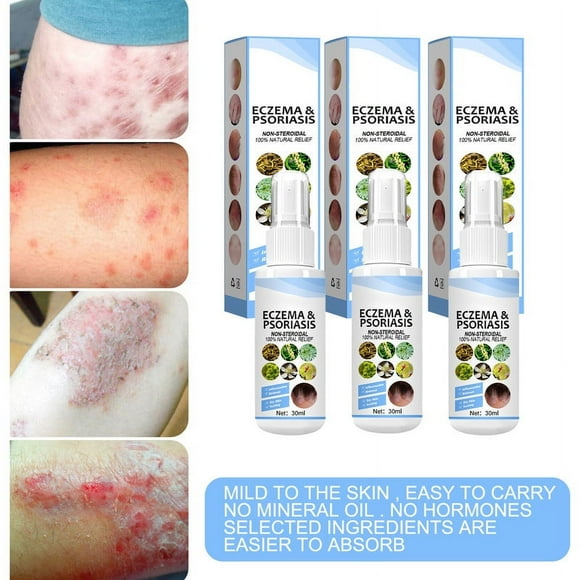 3PCS Anti Itch Spray &Antiseptic, Bacteriostatic Spray Body Itch Psoriasis Relief Moisturizing Spray for Psoriasis Treatment for Foot odor & eczema Dry Skin Itch Relief Body Care