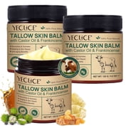 3Pack Tallow + Castor + Frankincense Skin Balm, 100% Pure Natural Deeply Nourishes & Hydrates, For Face, Body, For All Skin Types