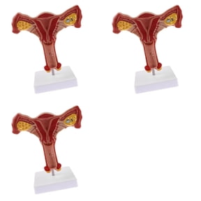 3X 1:1 Human Female Uterus Ovary Fallopian Tubes Model Anatomical Human Anatomy Model Teaching Tools