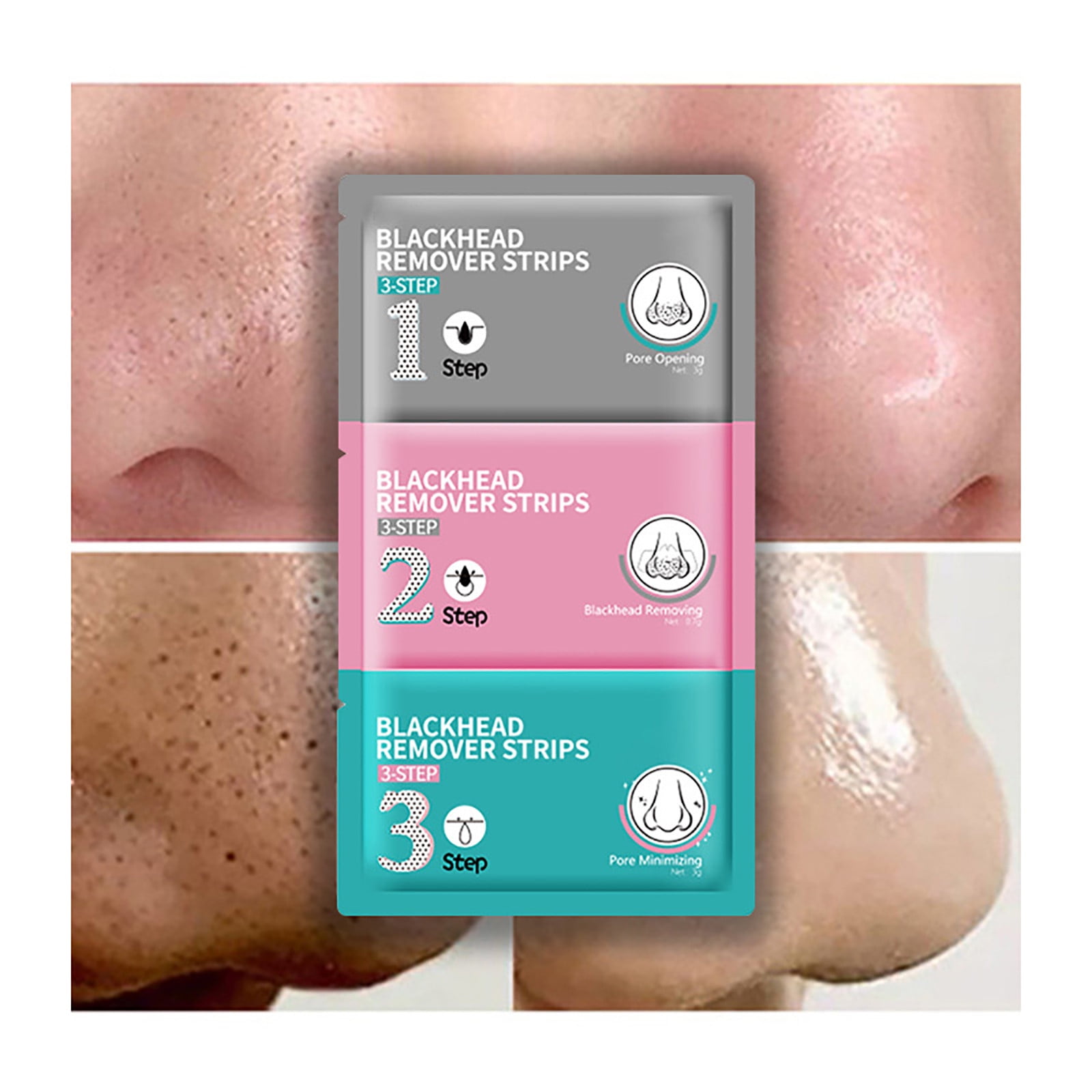 Big Blackheads: The Ultimate Step By Step Removal Guide - 2arxyk0