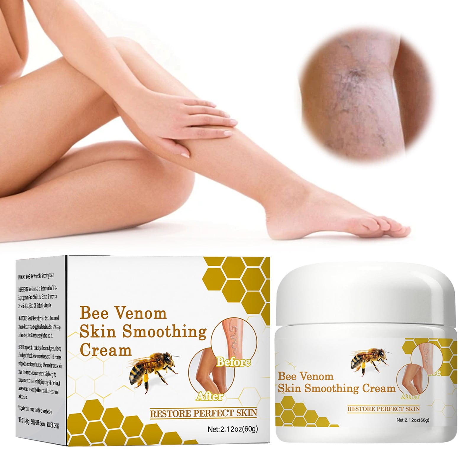 3packs Body Care,Varicose Vein Varicose Vein Rice Test Ointment