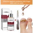 3pcs Lanbena Nail Repair Essence Remove Onychomycosis Serum Fungal Nail Treatment A+