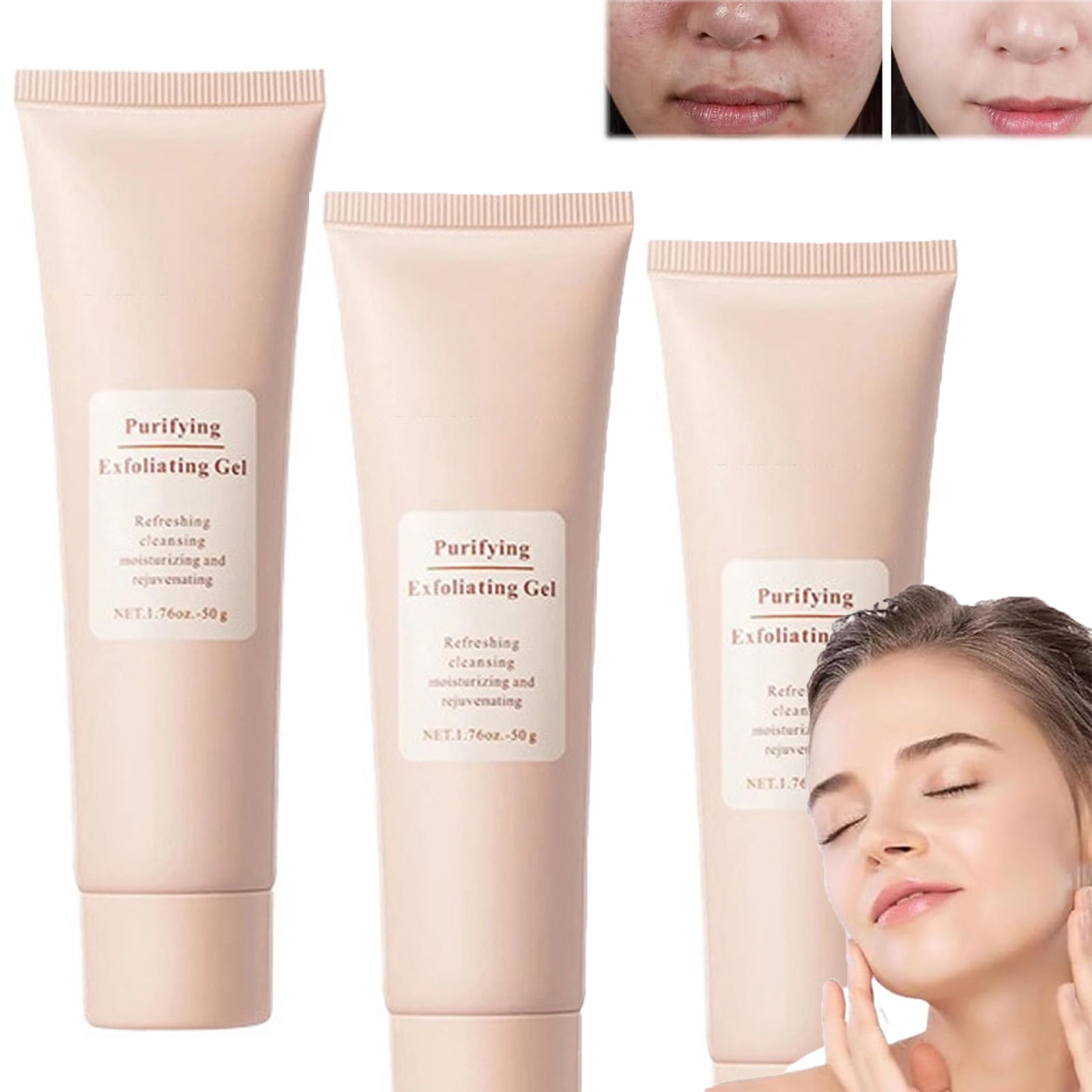 3x Peeling-Gel Für Gesicht & Körper – Entfernt Abgestorbene Haut, Spendet Feuchtigkeit