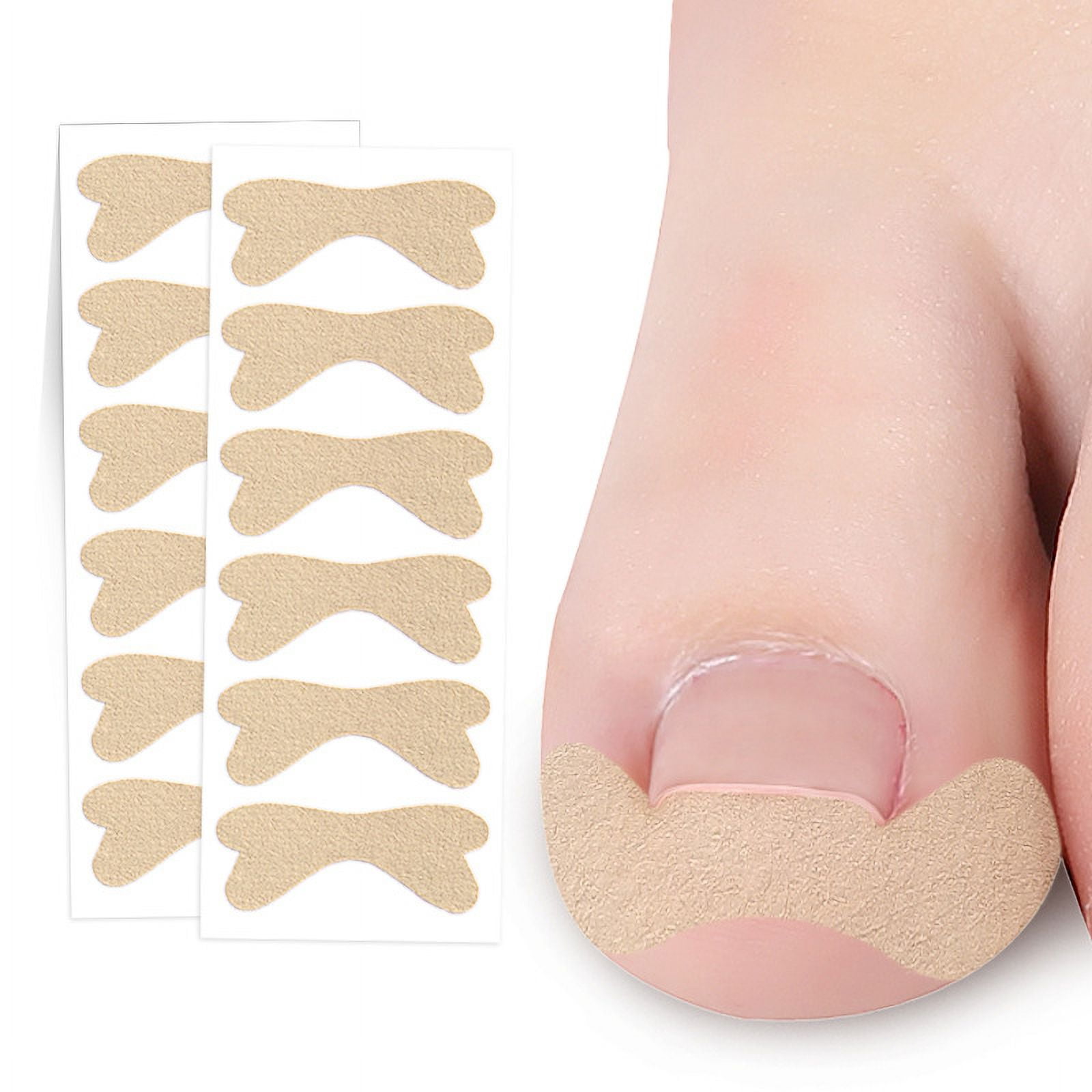 4 Sheets Ingrown Toenail Treatment Ingrown Toenail Patch Toenail ...