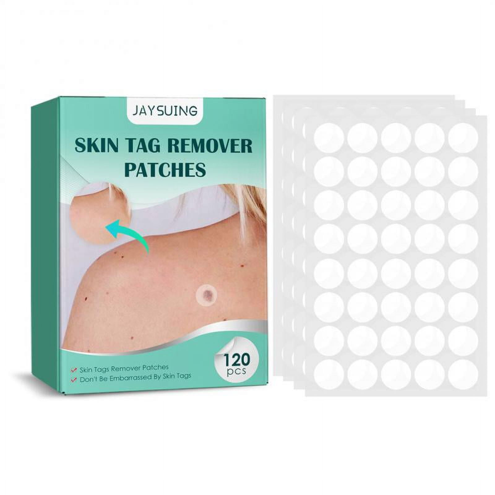 480120pcs Warts Remover Patch Skin Tags Pimple Treatments Cream