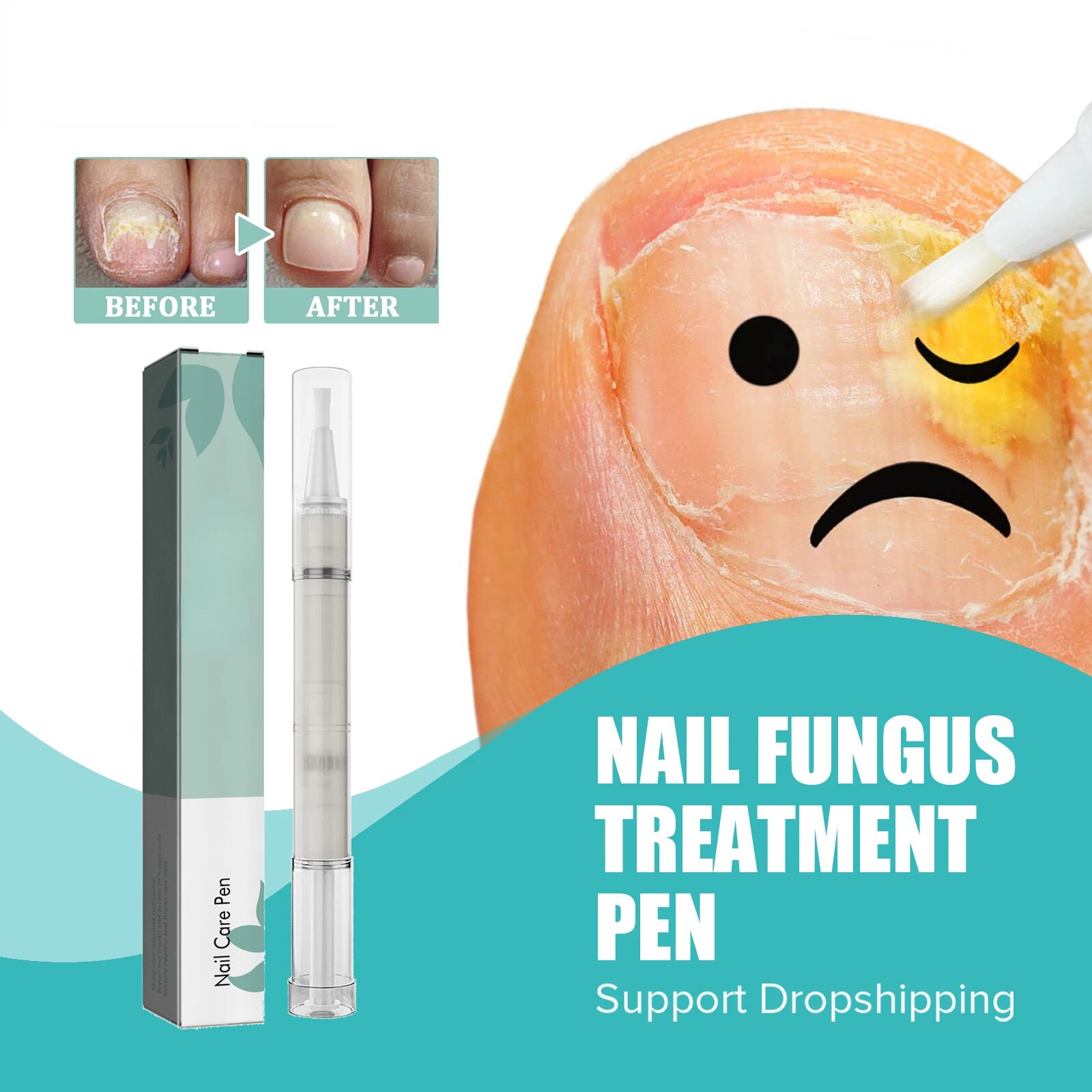 4ml Nail Fungal Treatment Essence Pen Soften Polish Cuticle Nail