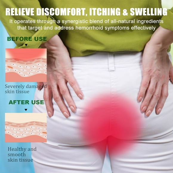 4pcs Herbal Hemorrhoids Care Ball, Relieve Perianal Itching Swelling Discomfort Herbal Essence Perianal Gentle Care
