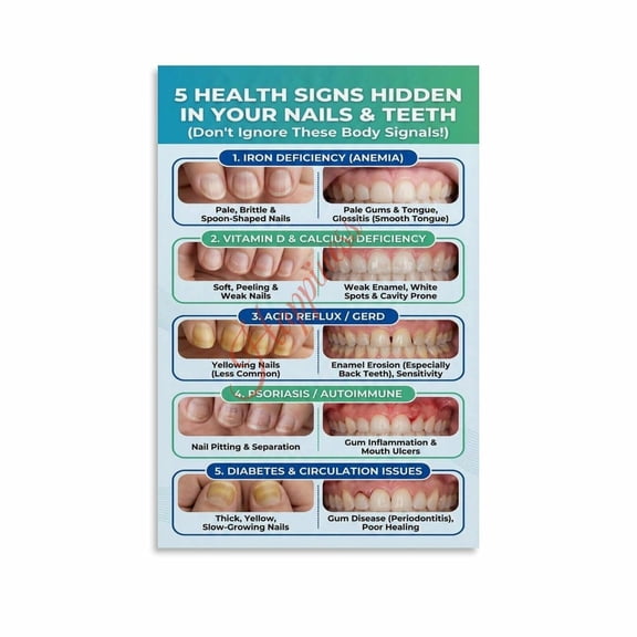 5 Health Signs Hidden in Your Nails And Teeth Poster Dental Health Wall Art Canvas Painting Wall Art Poster for Bedroom Living Room Decor