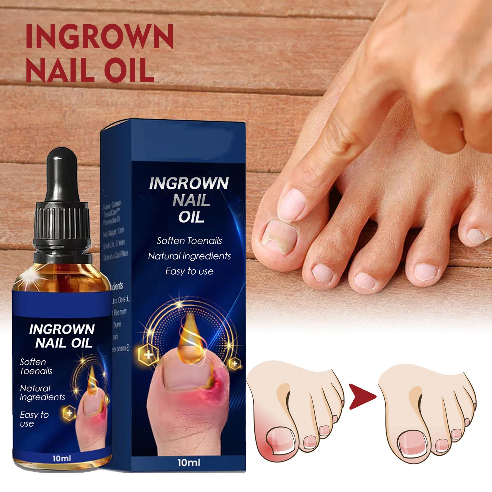 50 off Cuhas Toe to Nail Care Oil, Used to Remove The Inner Growth