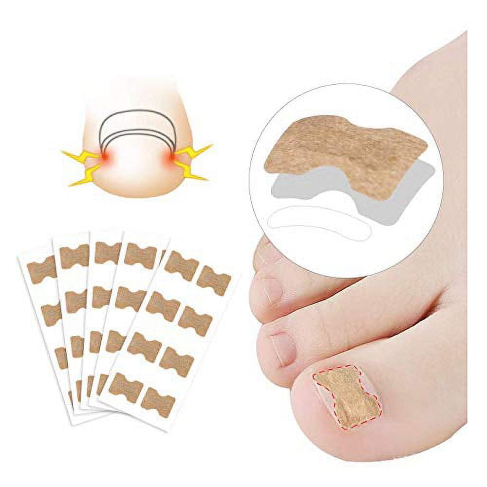 50PC Glue Free Toenail Patch Ingrown Toenail Tools Kit Premium Nail