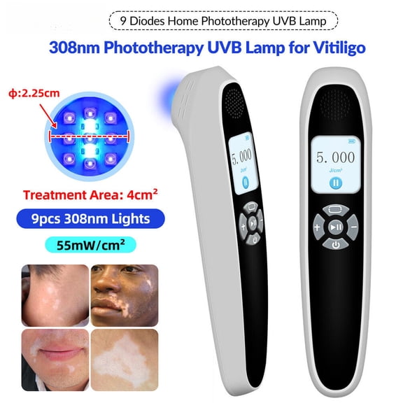 55mW/cm 308nm Excimer UV Light Phototherapy Device for Skin Disease Treatment