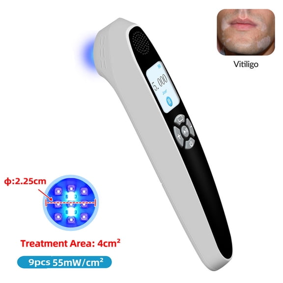 55mW/cm 308nm Excimer UVB Phototherapy Device for Skin Treatment
