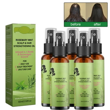 5PCS Organics Rosemary Mint Scalp & Hair Strengthening Oil With Biotin & Essential Oils, Nourishing Treatment for Split Ends and Dry Scalp for All Hair Types, 2-Fluid Ounces