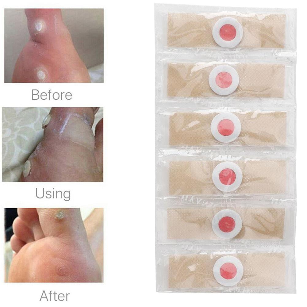 6/48Pcs Foot Corn Remover Pads Plantar Wart Thorn Plaster Patches