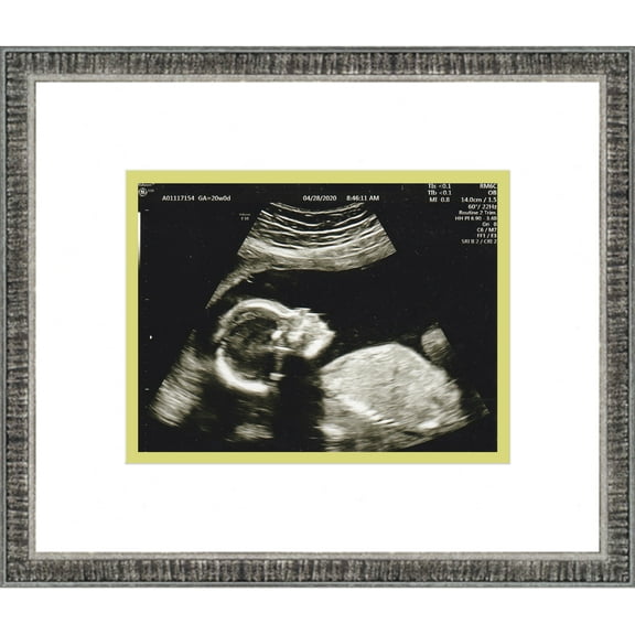 6x5 Rustic Silver Sonogram Frame with White on Green Mats with 1 Opening to Display 1 4x3 Sonogram