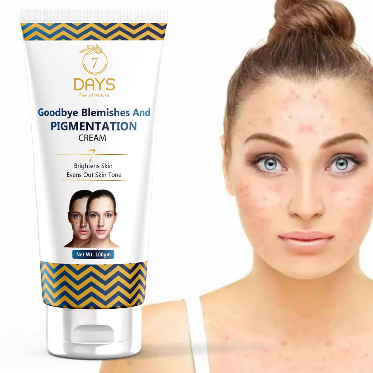 Bye Bye Press Ons Removal System 7 Days Bye Bye Pigmentation Blemishes Removal Cream || Anti