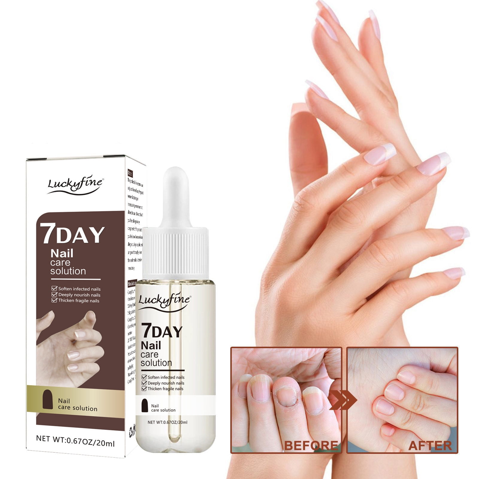 7 Days Nail Growth And Strengthening Serum, Nail Repair Essence ...