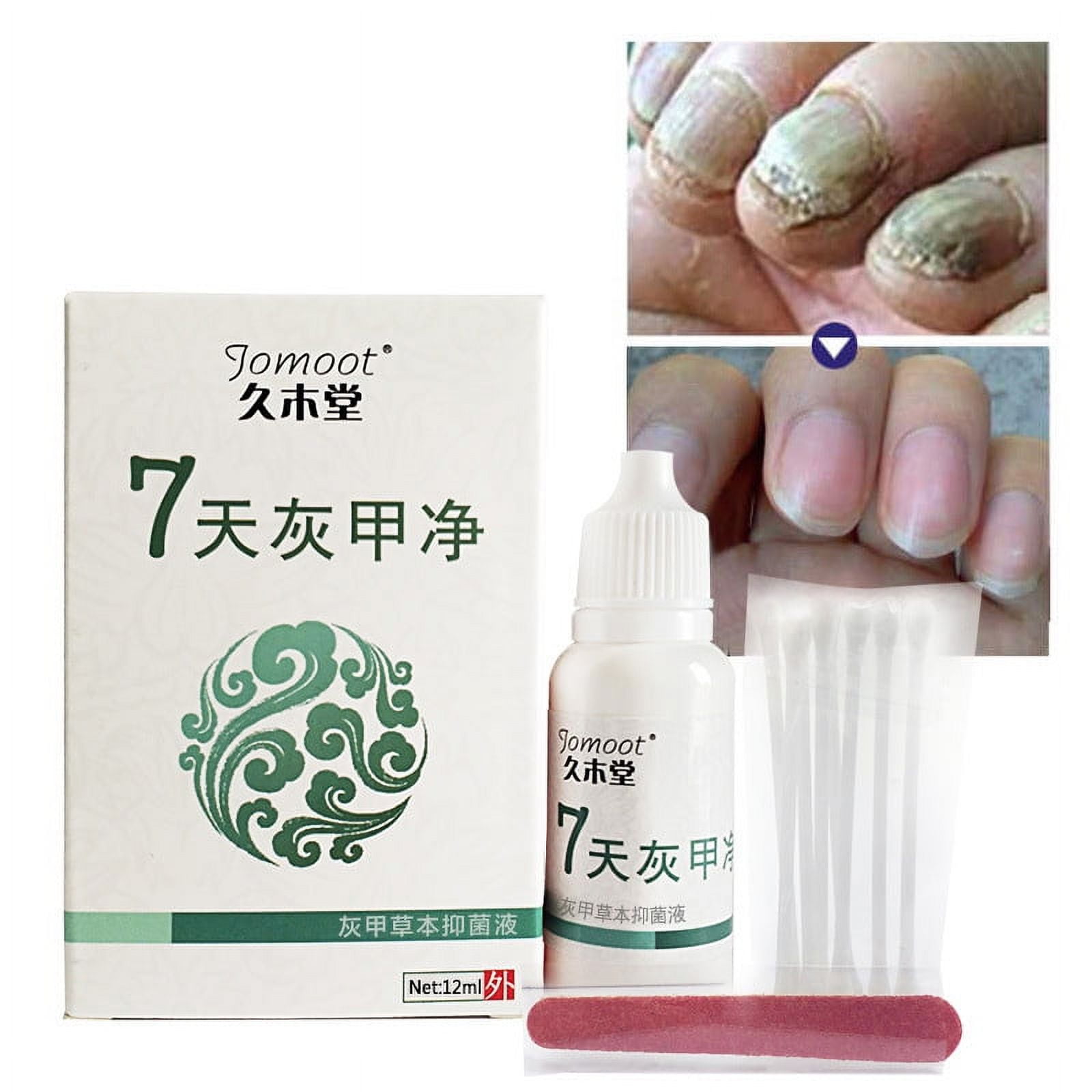 7 Days Onyx Toe Finger Nail Fungus Treatment Anti Fungal Infection With