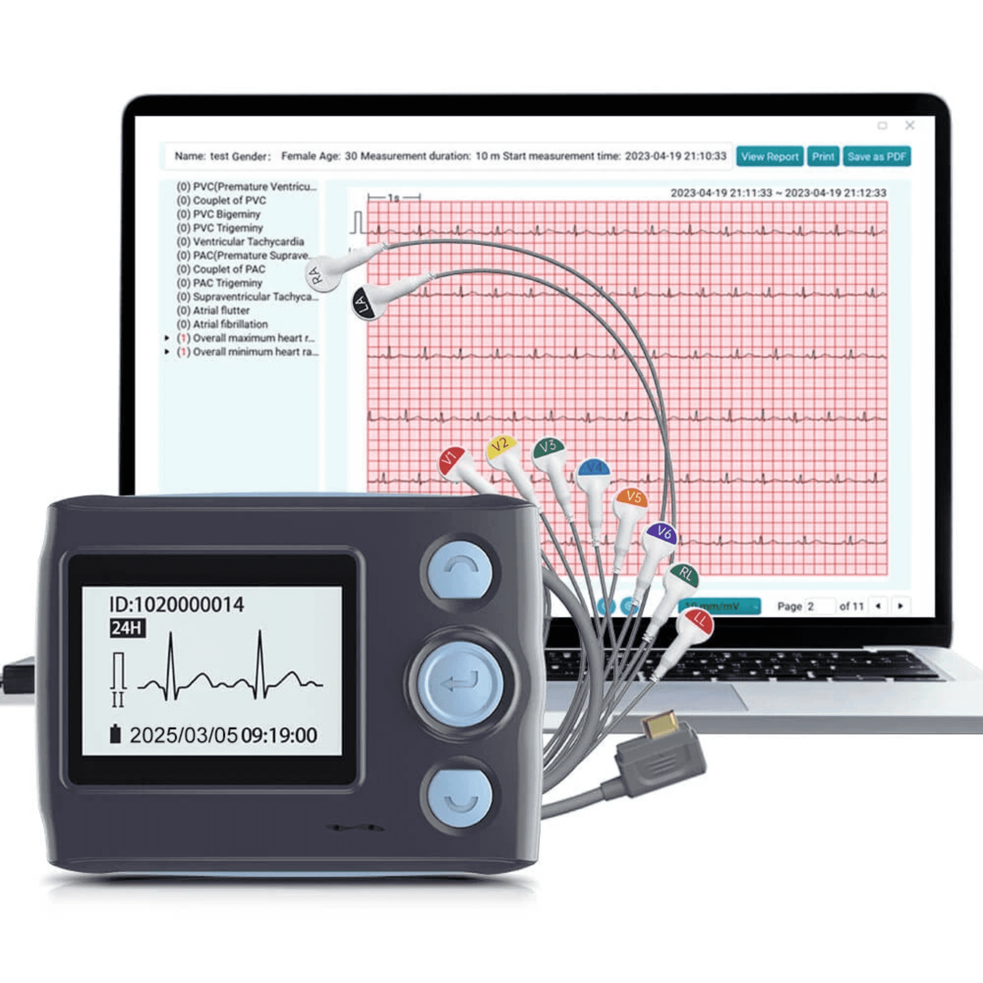 Holter Monitor Heart Ecg App 5+ Hundred Ambulatory - Main Image