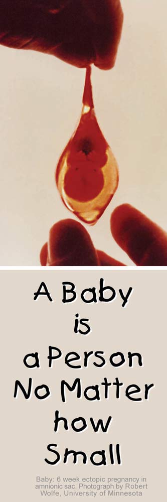 A Baby is a Person Pro-Life Bookmark