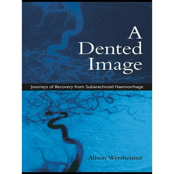 A Dented Image: Journeys of Recovery from Subarachnoid Haemorrhage, (Hardcover)