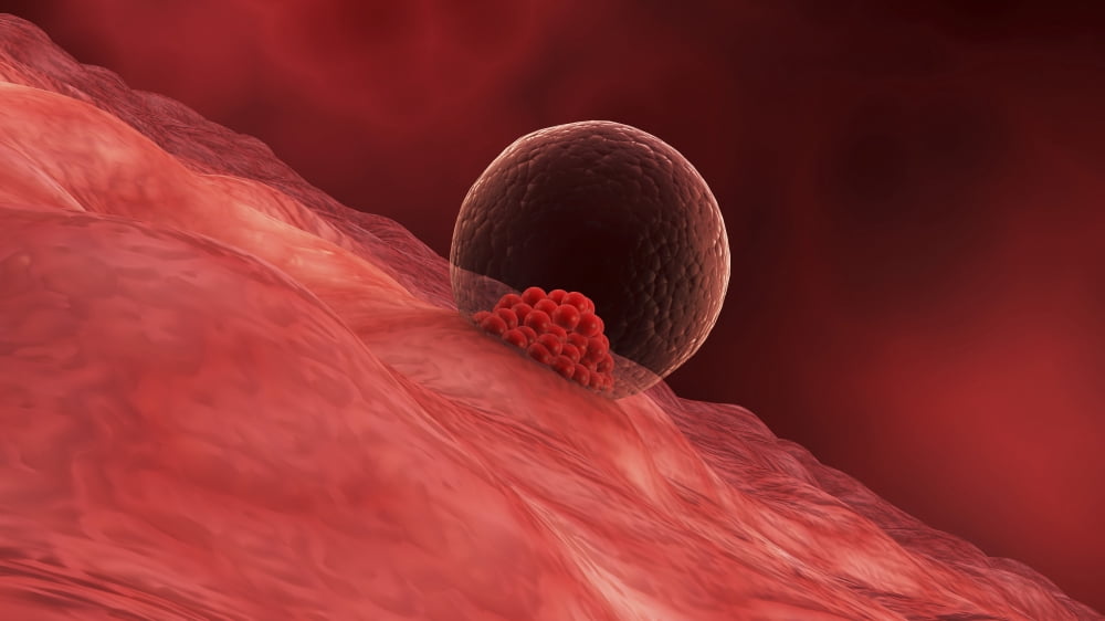 A blastocyst begins implanting in the wall of the uterus Canvas Art - Stocktrek Images (19 x 11)