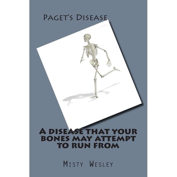 A disease that your bones may attempt to run from (Paperback)