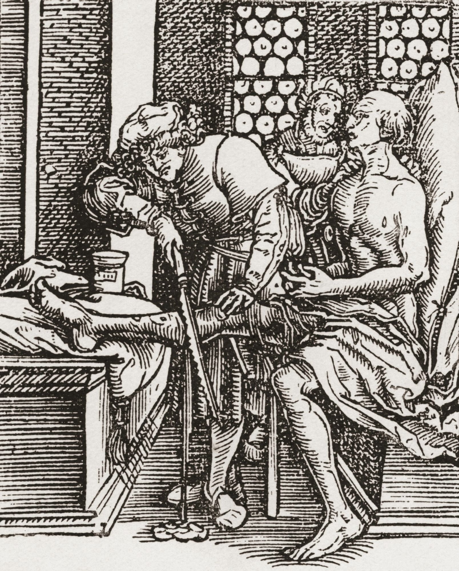 A physician performing an amputation during the Tudor period in England From a contemporary print Canvas Art - Ken Welsh Design Pics (12 x 15)