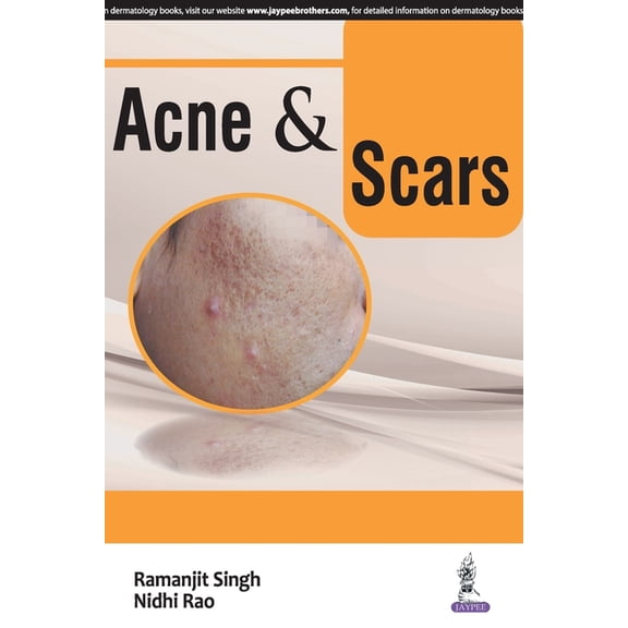 ACNE and SCARS, (Paperback)