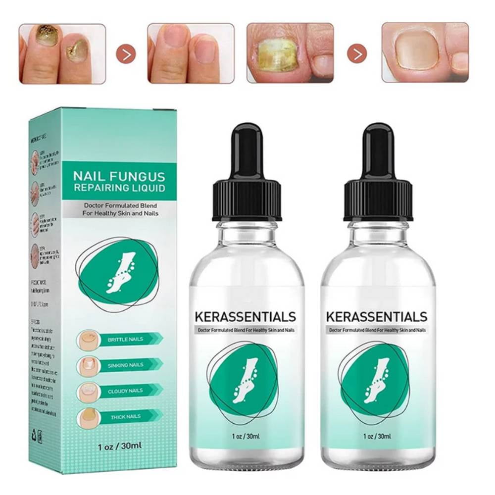 ACRDDK 2pcs Toenail Repair Solution Onychomycosis Repair Solution