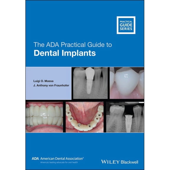 ADA Practical Guide: The ADA Practical Guide to Dental Implants (Paperback)
