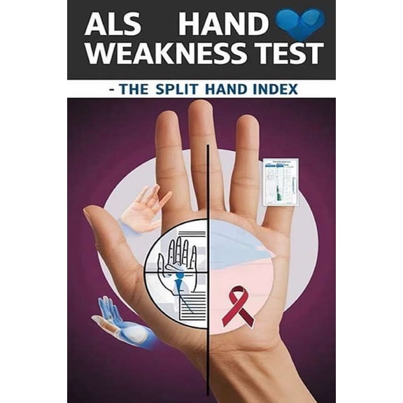 ALS Hand Weakness Test - The Split Hand Index: The split hand index might suggest hand weakness specifically due to ALS., (Paperback)