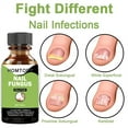 ANTI FUNGAL TREATMENT EXTRA STRENGTH TOENAIL FUNGUS FUNGI XS NAIL ATHLETE'S FOOT