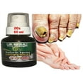 ANTI FUNGAL support EXTRA STRENGTH TOENAIL FUNGUS FUNGI XS NAIL ATHLETE'S FOOT 2 oz Made in USA