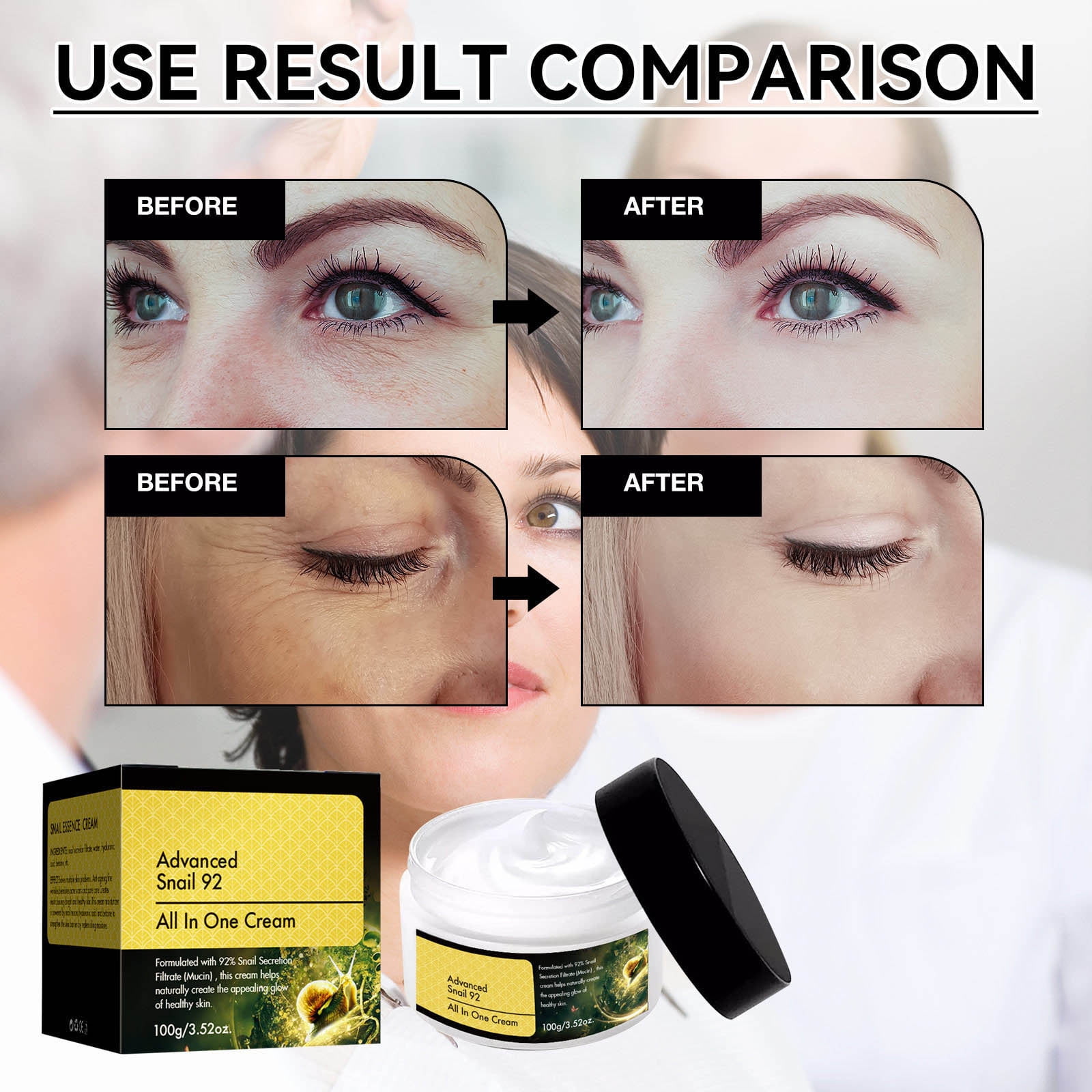 APOKIOG Mucin 92 Daily Face Gel Moisturizer For Dry Skin Prone Sensitive Skin Not Tested On