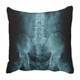 thumbnail image 1 of ARHOME Osteoporosis X Ray L Spine with Spondylosis Adult Aged Anatomy Back Bend Black Body Pillowcase 18x18 inch, 1 of 1