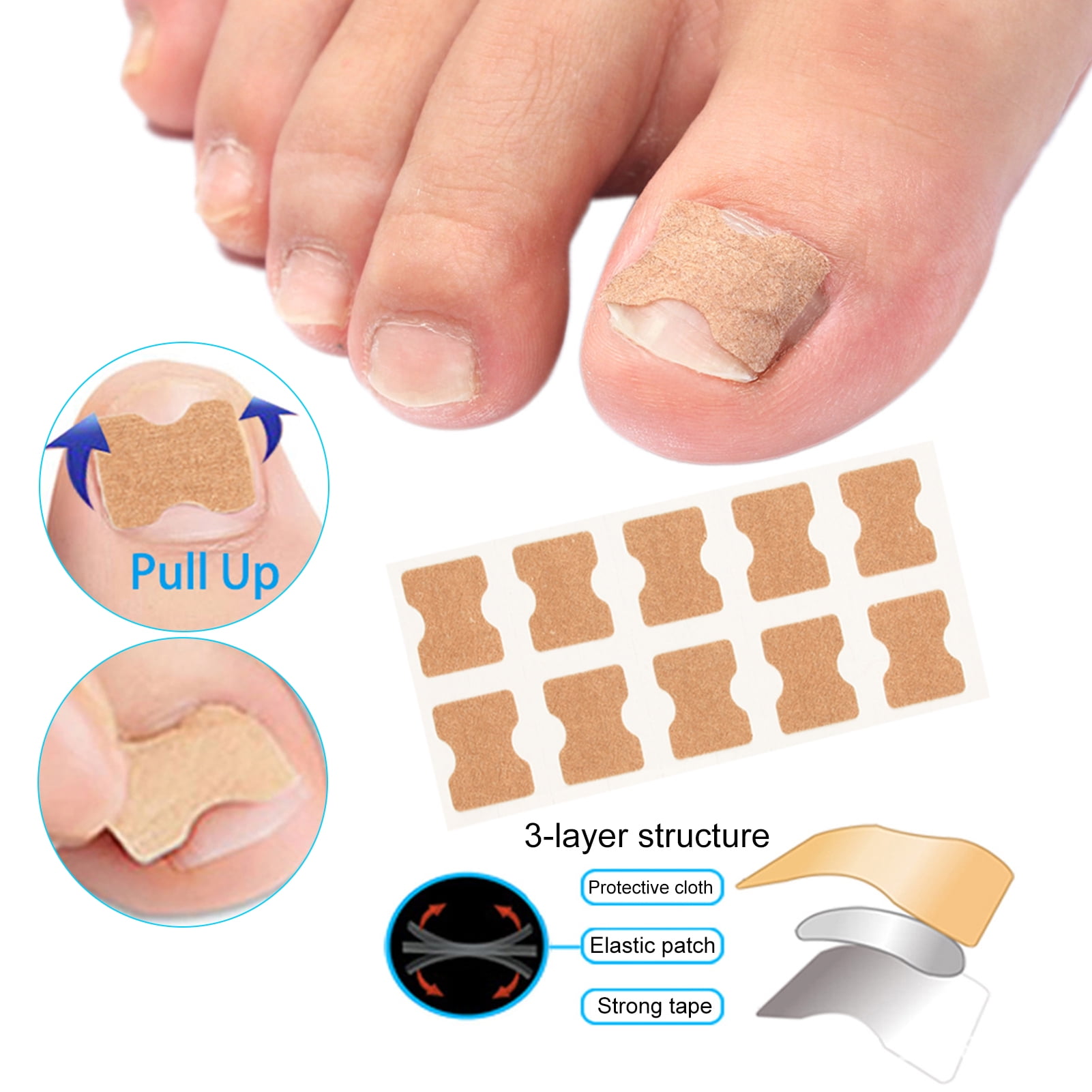 AURORA TRADE 100Pcs Toenail Corrector Patch Ingrown Toe Nail