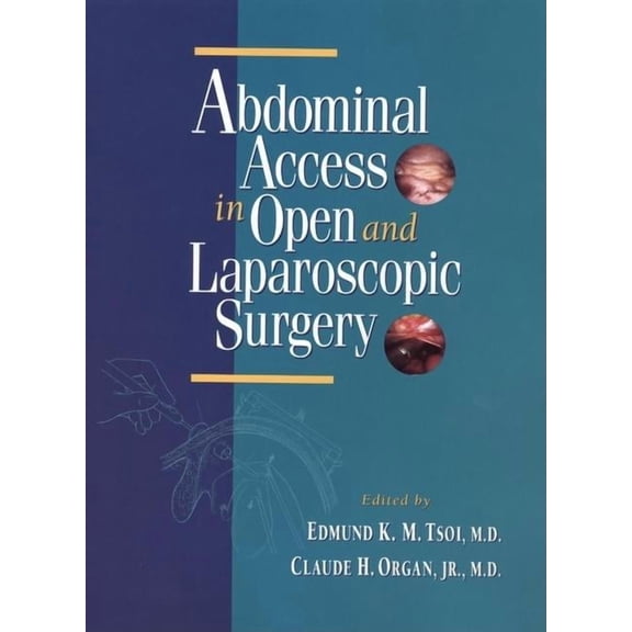 Abdominal Access in Open and Laparoscopic Surgery, (Hardcover)