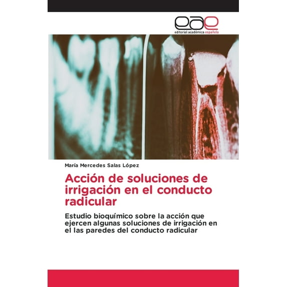 Acción de soluciones de irrigación en el conducto radicular (Paperback)