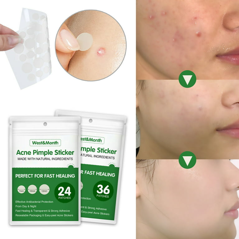 Acne Pimple Sticker Patch Skin Repair