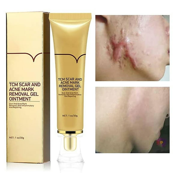 Acne Scar Removal Cream Stretch Marks Face Skin Cream Shrink Pores Gel-Fade Scar Marks Acne Cream Skin Care (Packaging Upgrade)