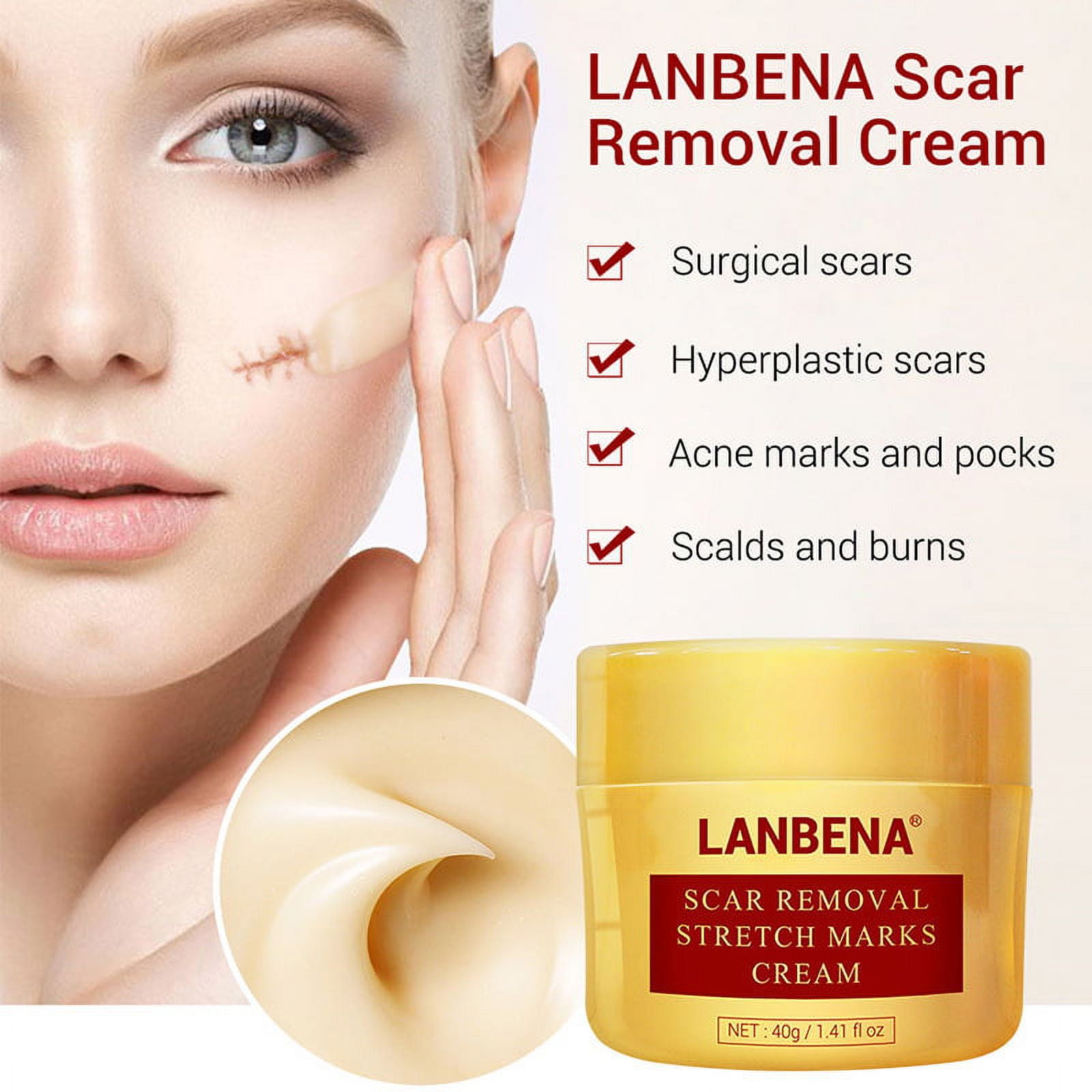 Acne scar 2024 removal products