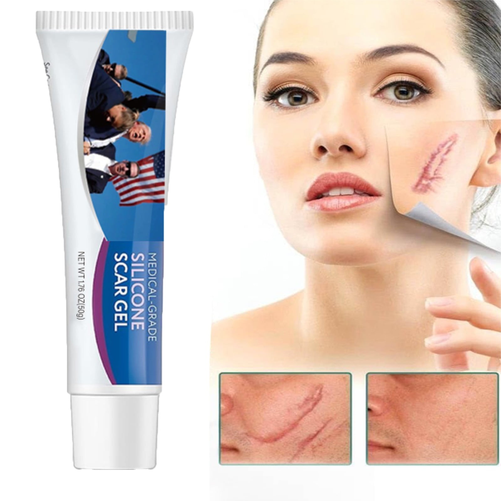 Acne Scar Treatment Scar Gel Scar Cream 1* Scar cream Advanced Scar Old and New Scars